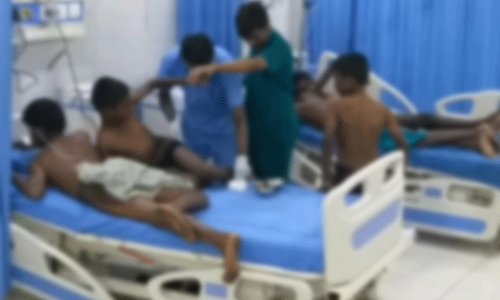 తోసుకున్న విద్యార్థులు.. మంటలు చెలరేగడంతో గాయాలు