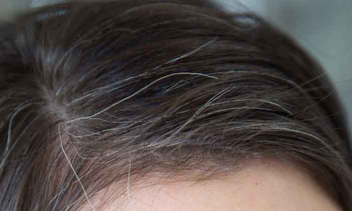 జుట్టు...నల్లా గా నుండి తెల్లగా ఎందుకు అవుతుందంటే!