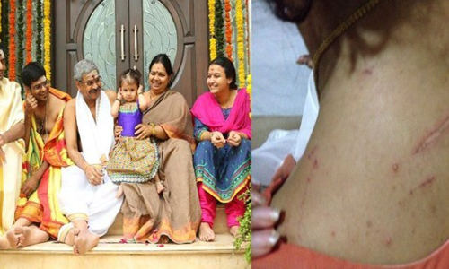 హైకోర్టు మాజీ జడ్జిపై కోడలి ఫిర్యాదు.. గాయాలివిగో..