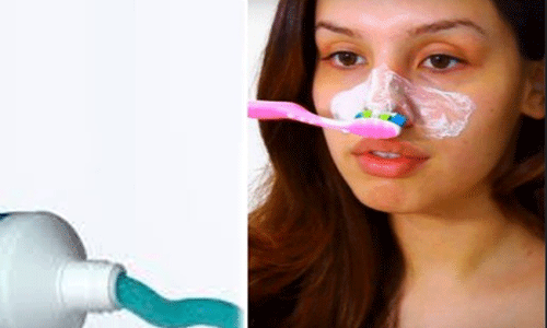 ముఖంపై టూత్పేస్ట్ తో ఇలా చేస్తే.. ముఖంపై టూత్పేస్ట్ తో ఇలా చేస్తే..