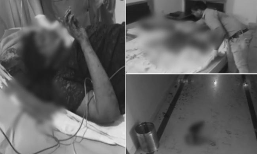 విషమంగా మనస్విని పరిస్థితి..మరో 48 గంటలు దాటితే కానీ..