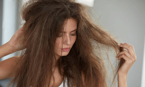 చుండ్రు సమస్యకు చిన్న చిట్కా! చుండ్రు సమస్యకు చిన్న చిట్కా!