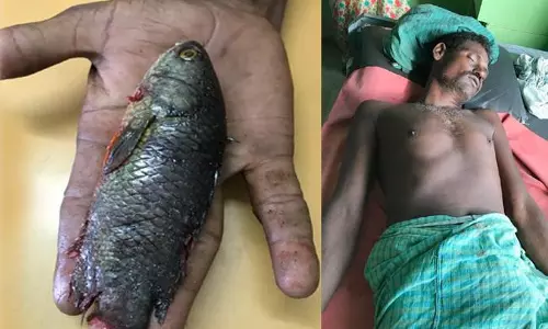 గొంతులో పచ్చివెలక్కాయ కాదు.. చేప పడింది..