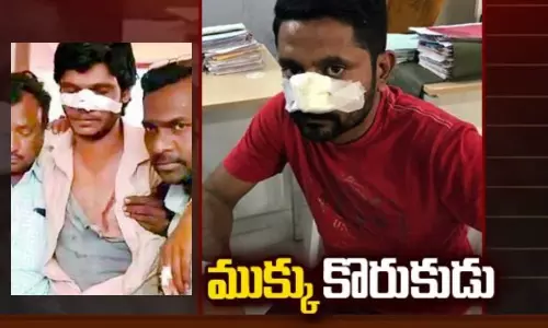 కోపమొస్తే కొరుకుడేనా.. తిట్టడం.. కొట్టడం..అలగడం ఓల్డ్ ఫ్యాషనా?