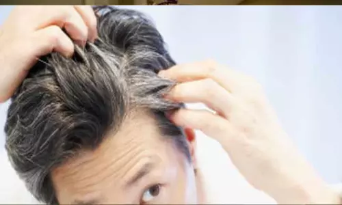 జుట్టు తెల్లబడటానికి కారణాలేంటి? తీసుకోవాల్సిన జాగ్రత్తలేంటి?