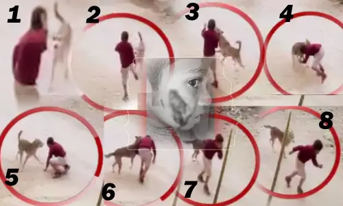 పాపం పసివాడు.. వీధి కుక్కకు చిక్కాడు!