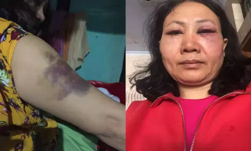 క్రీడాకారిణి సూరజ్ లతాదేవికి వరకట్న వేధింపులు క్రీడాకారిణి సూరజ్ లతాదేవికి వరకట్న వేధింపులు