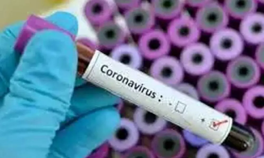 Coronavirus: ఏపీలో ప్రమాద ఘంటికలు.. లక్షణాలు లేకున్నా 14 మందికి కరోనా పాజిటివ్