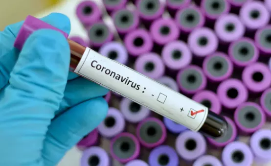 Coronavirus: ఆఫ్ఘనిస్తాన్‌లో కేవలం 6వేల పరీక్షలే.. కారణం ఇదే..