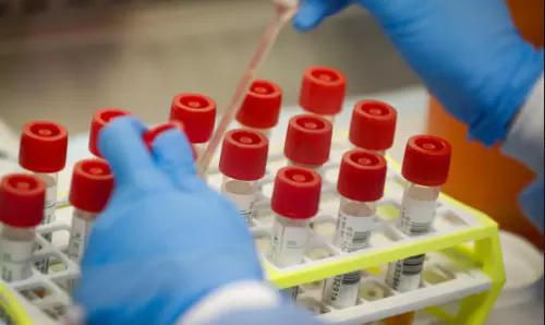 ఏపీలో నిన్న ఒక్కరోజే దాదాపు ఏడువేల పరీక్షలు