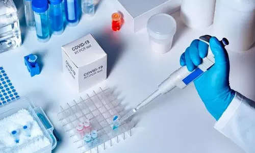 ఏపీలో కేసులు ఎక్కువైనా ఇదే రైట్ వే..!