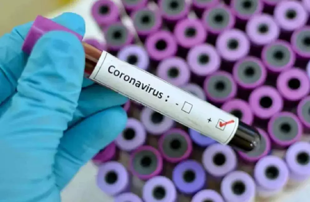 coronavirus : ఏపీలో రికార్డు స్థాయిలో 22,371 వేల పరీక్షలు.. కేసులు చూస్తే..