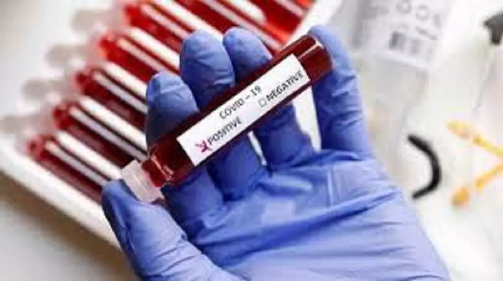 Coronavirus outbreak in Telangana: తెలంగాణలో 11 వేలు దాటిన కేసులు.. జీహెచ్ఎంసీలో దుకాణాలన్ని స్వచ్ఛందంగా బంద్