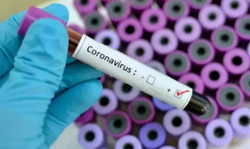 Coronavirus Updates in Andhra pradesh: ఏపీలో 13 వేలు దాటిన పాజిటివ్ కేసుల సంఖ్య.. ఇవాళ 12 మంది మృతి