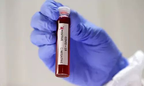 Coronavirus Updates in Telangana: తెలంగాణలో మళ్ళీ భారీగా పెరిగిన కరోనా కేసులు! Coronavirus Updates in Telangana: తెలంగాణలో మళ్ళీ భారీగా పెరిగిన కరోనా కేసులు!