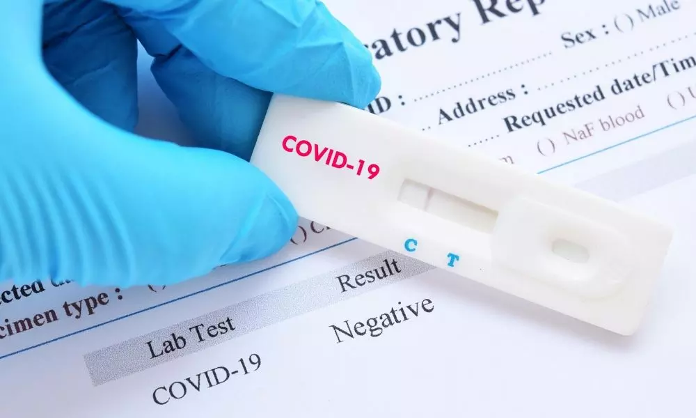 Coronavirus Rapid Test kit Hyderabad: ర్యాపిడ్‌ టెస్టులకు ఓకే.. రాష్ట్ర ప్రభుత్వం కీలక నిర్ణయం
