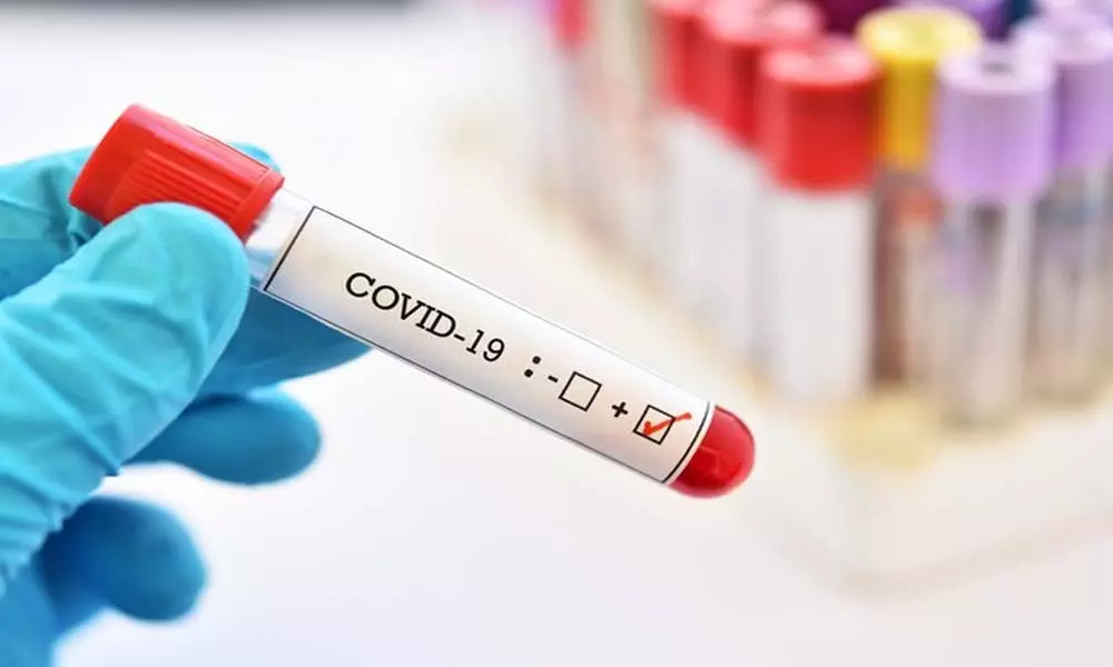 Coronavirus Updates in Telangana: తెలంగాణలో ఒక్కరోజే రికార్డు.. జీహెచ్‌ఎంసీలో నే అత్యధికంగా 1,658