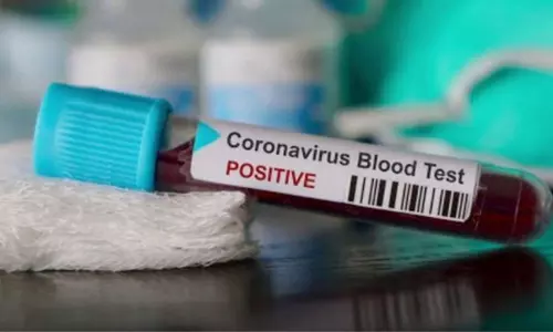 Andhra Pradesh create record in corona tests : ఆంధ్రప్రదేశ్ కరోనా నిర్థారణ పరీక్షల్లో ఆంధ్రప్రదేశ్ మరో రికార్డు