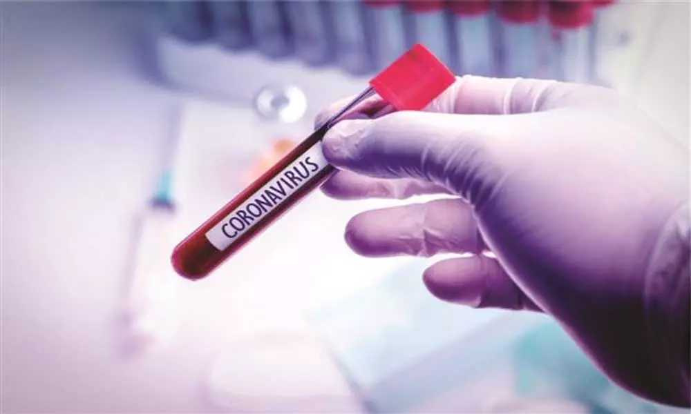 Coronavirus Updates in AP: ఆంధ్రప్రదేశ్ లో 50 వేలు దాటిన కరోనా కేసులు..