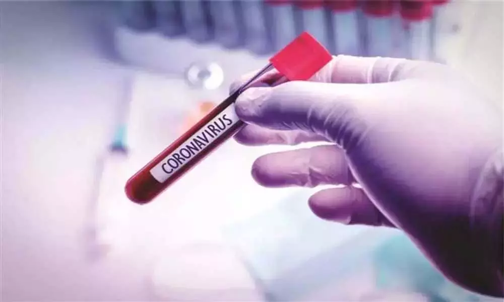 Coronavirus Updates in AP: ఏపీలో కొత్తగా 8,147 కేసులు..