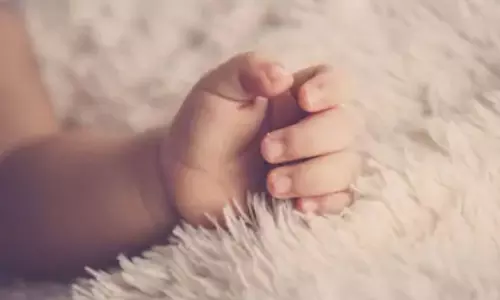 ఒంటికన్నుతో శిశువు జననం