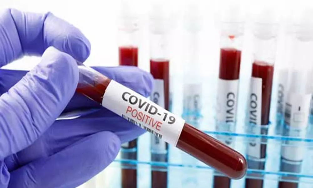 Coronavirus Updates in AP: ఏపీలో కొత్తగా 10,276 పాజిటివ్ కేసులు..