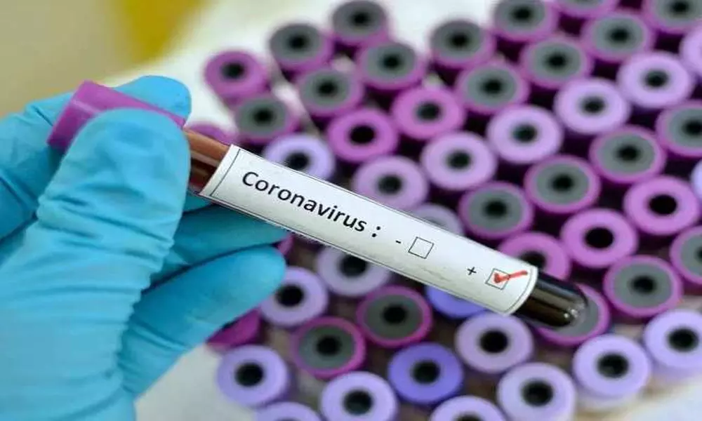 Coronavirus Updates in India: భారత్‌లో కొత్త‌గా 61,408 కరోనా పాజిటివ్ కేసులు