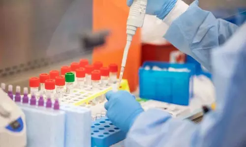 Coronavirus Tests in AP: కరోనా టెస్ట్ రేట్లు తగ్గించిన ఏపీ ప్రభుత్వం..