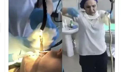 మహిళ కడుపులోనుంచి నాలుగు అడుగుల పామును బయటకు తీసిన వైద్యులు (వీడియో)