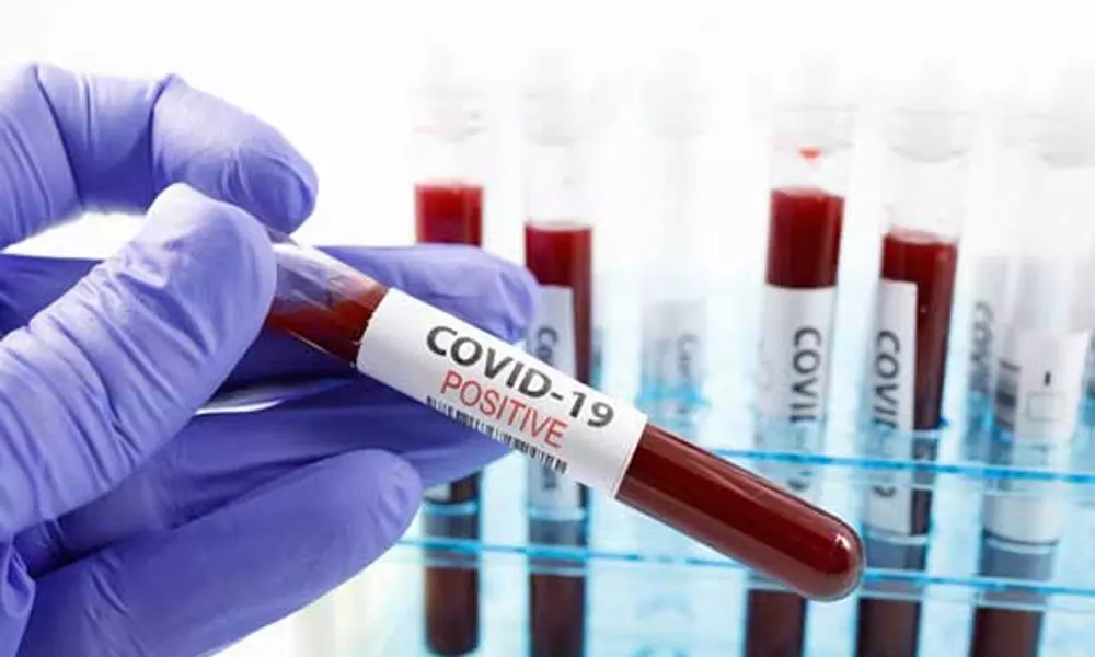 Coronavirus Updates in AP:  ఏపీలో అయిదు లక్షలకు చేరిన కరోనా కేసులు!