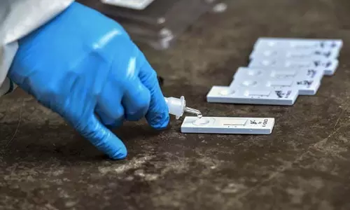 కరోనా కాటుకు బలైన సీపీఐ(ఎం) సీనియర్ నేత