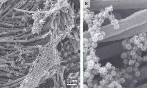 శ్వాసకోశ నాళాలపై కరోనా ప్రభావం వివరించే ఫొటోలు విడుదల