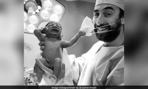 పుట్టడంతోనే మాస్క్ తీస్తున్న శిశువు.. సోషల్ మీడియాలో వైరల్ అవుతోన్న ఫొటో