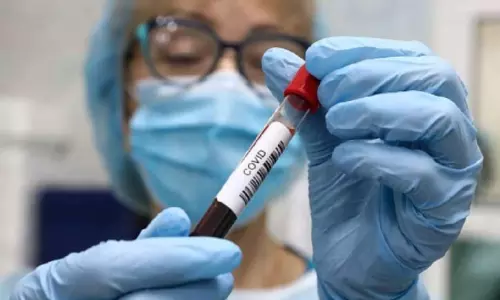 ఏపీలో భారీగా తగ్గిన కరోనా కేసులు! ఏపీలో భారీగా తగ్గిన కరోనా కేసులు!