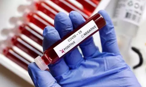 ఏపీలో భారీగా పడిపోయిన కరోనా కేసులు! ఏపీలో భారీగా పడిపోయిన కరోనా కేసులు!