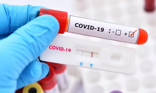 CoronaVirus Update:  ఏపీ కొత్తగా 227 మందికి కరోనా పాజిటివ్
