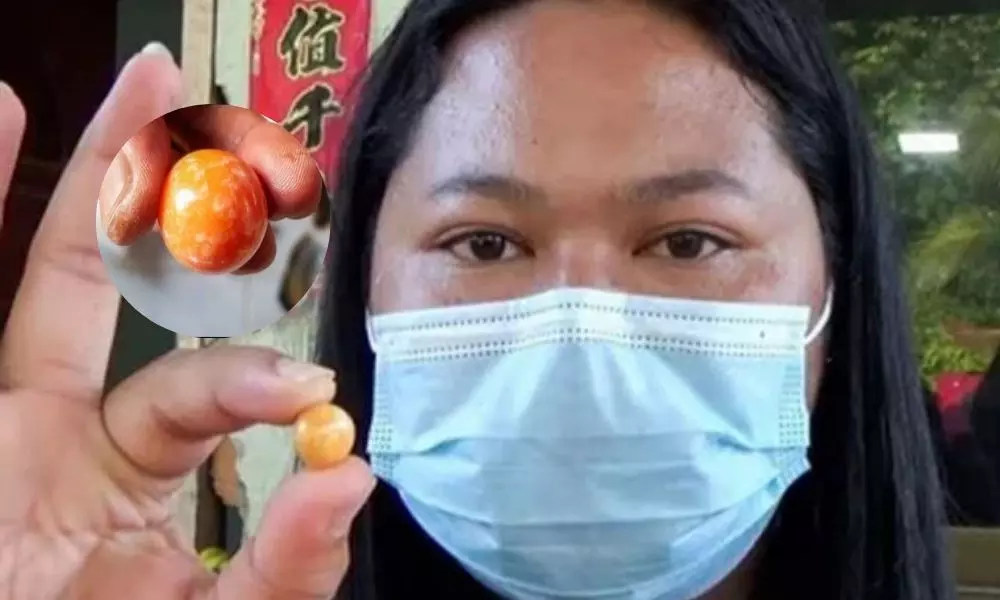 Thailand Poor Woman Finds Orange Melo Pearl Worth Crores of Rupees
