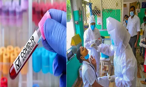 Corona Virus AntiBodies For Womens