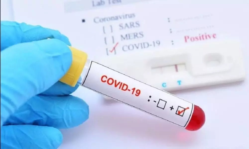 20,034 New Coronavirus Cases Reported in Andhra Pradesh on 04 MAY 2021
