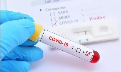 20,034 New Coronavirus Cases Reported in Andhra Pradesh on 04 MAY 2021