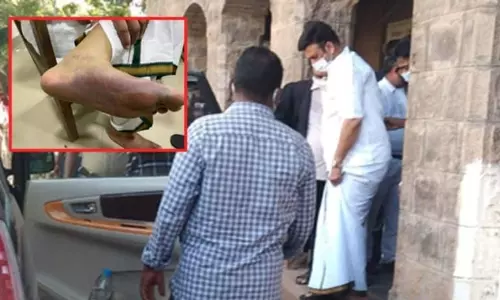 Doctors done the 18 Types of Tests To The YSRCP MP Raghu Rama Krishnam Raju