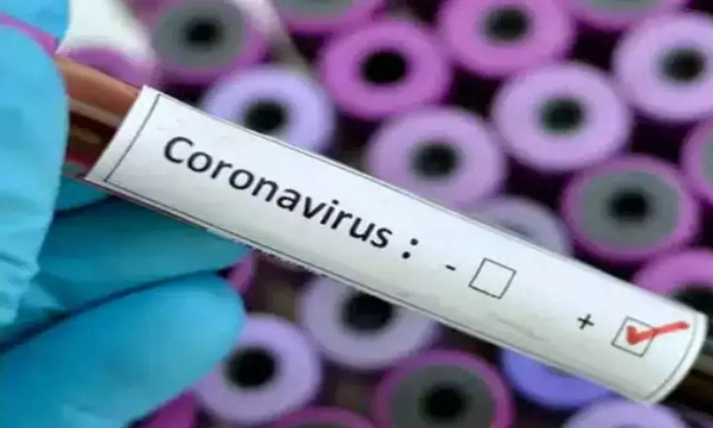 21230 New Coronavirus Cases Reported in Andhra Pradesh Today 18-05-2021