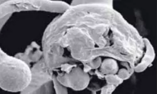 white Fungus white Fungus