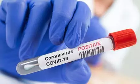 3043 New Coronavirus Cases Reported in Tealngana on 24 MAY 2021