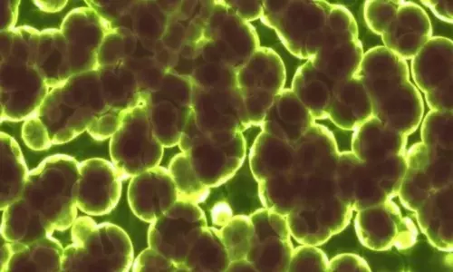 Yellow Fungus Infection Cases Reported India | Live News Updates Today