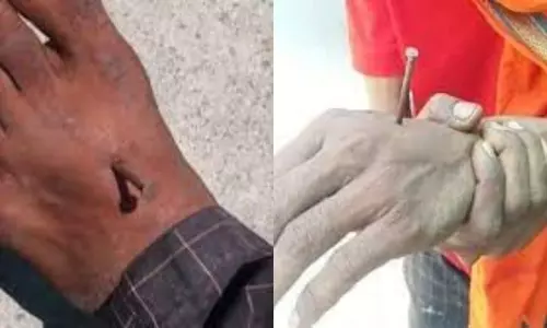 Up Woman Alleges Cops Nailed Her Sons Limbs for not Wearing Mask