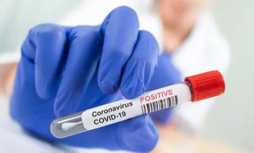 3614 New Coronavirus Cases Reported in Tealngana on 27 MAY 2021