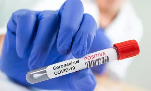 2524 New Coronavirus Cases Reported in Tealngana on 31 MAY 2021