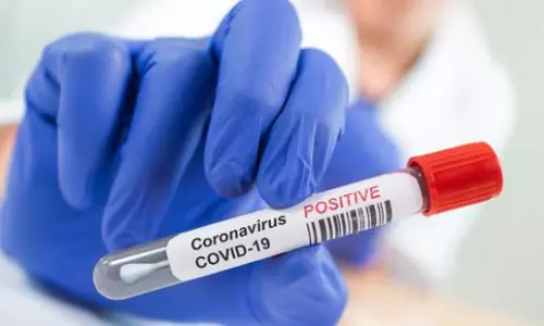 2524 New Coronavirus Cases Reported in Tealngana on 31 MAY 2021