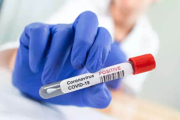 10373 ‍New Coronavirus cases Reported in Andhra Pradesh Today 05 06 2021